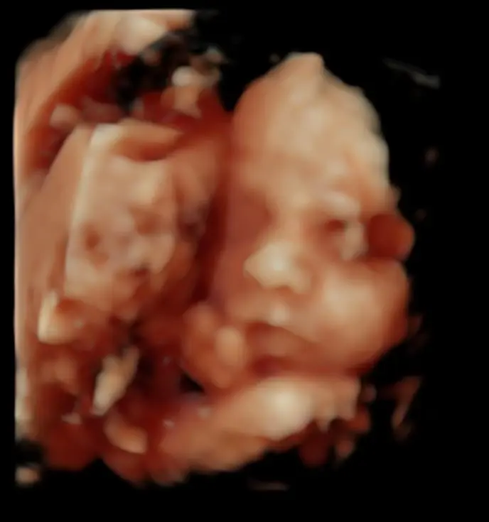 The New Baby Scan